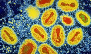 variole cree laboratoire adn internet