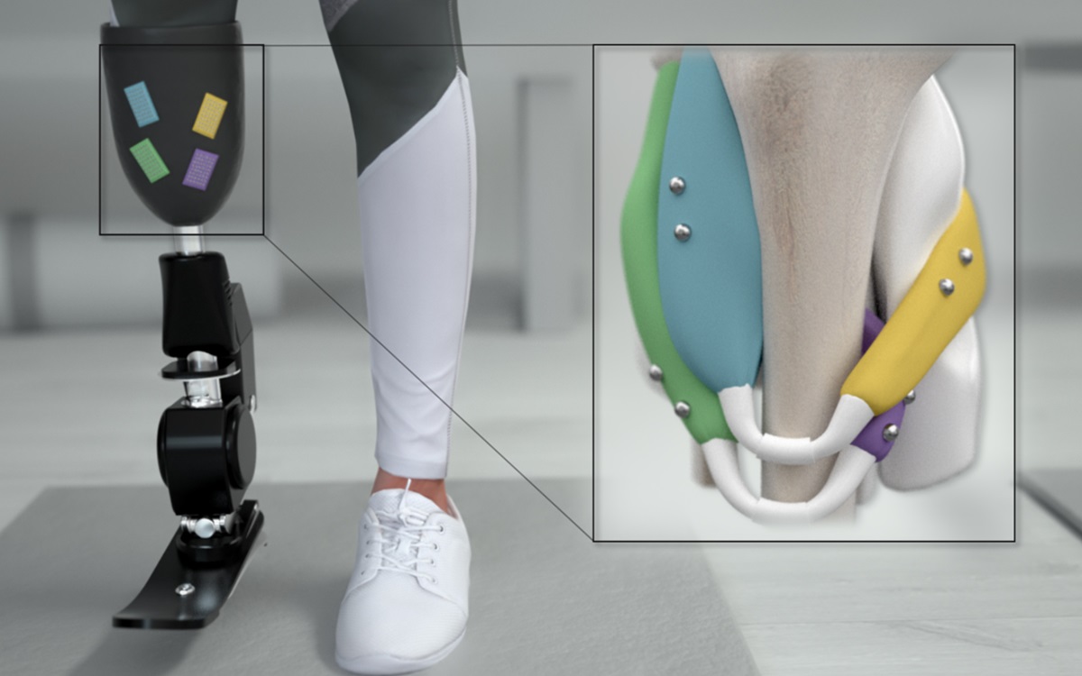 Robotique : cette nouvelle jambe bionique peut être contrôlée par la pensée