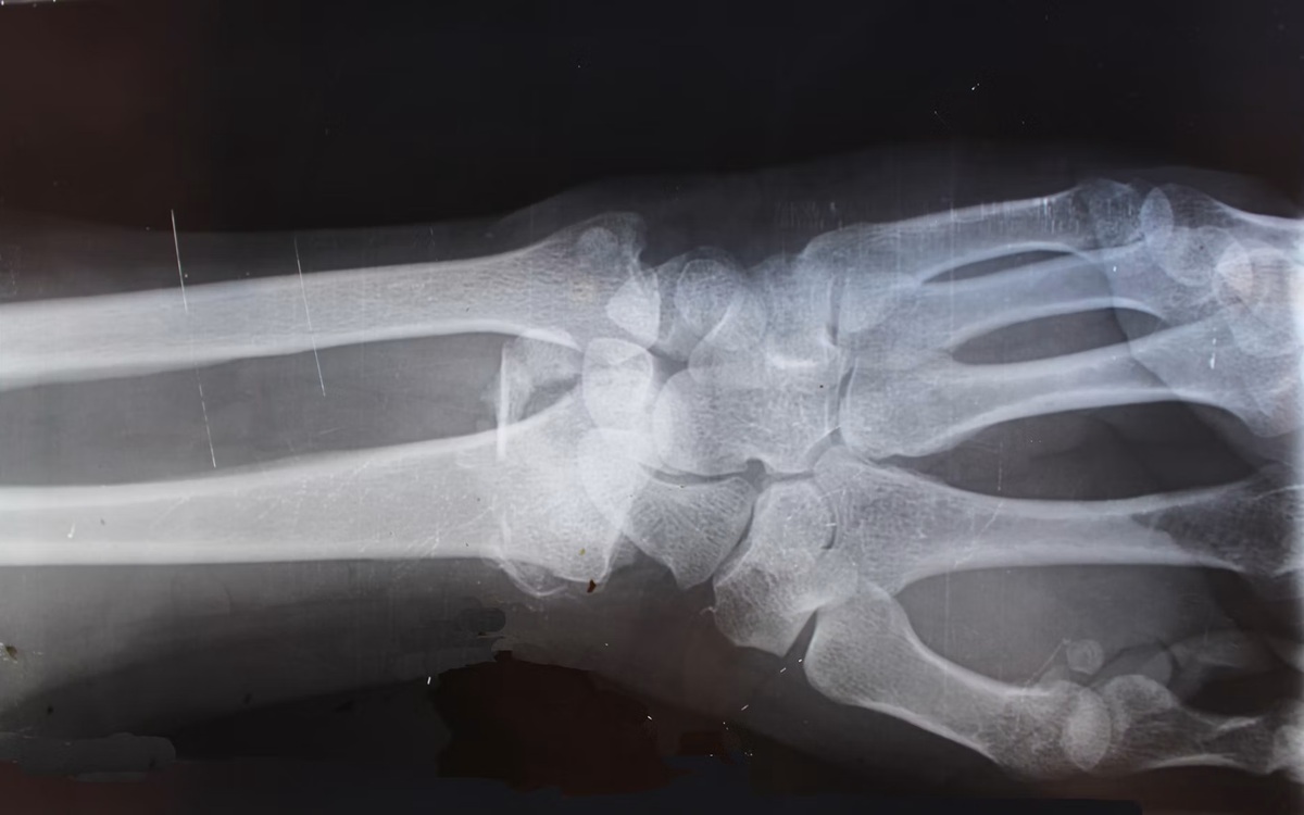 Des chercheurs réussissent à faire une radiographie dans l’espace, une première historique